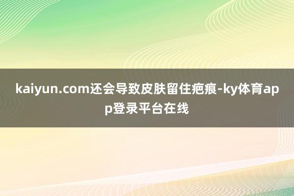 kaiyun.com还会导致皮肤留住疤痕-ky体育app登录平台在线